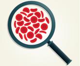 In reply: Complete blood cell count