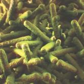 A small number of neonatal listeriosis cases may be of nonmaternal origin