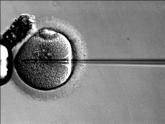 ICSI use without male factor infertility climbs, but births decline