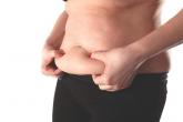 Radiofrequency Device Significantly Cut Abdominal Fat