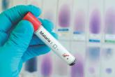 Malaria vaccine disappoints in phase II trial