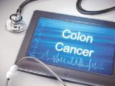 Task force affirms value of colorectal cancer screening