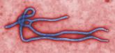 Rapid diagnostic tests used to detect Ebola