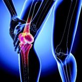 Less symptomatic patients ‘worse off’ after knee surgery