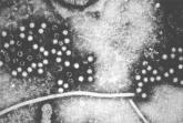Hepatitis E linked to 1 in 10 liver failure cases in Europe
