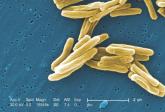 MPT64 rapid test may miss TB caused by M. africanum strain