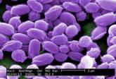 Environmental factors could increase U.S. anthrax cases