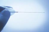 Acupuncture no better than sham for relief of hot flashes