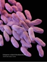 Carbapenem resistance on the rise in children