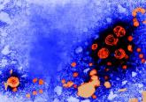 Hepatitis B perinatal infection risk factors identified
