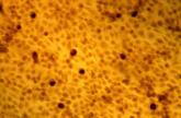 Point-of-care chlamydia, gonorrhea assay as good as lab test