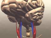 Mechanical thrombectomy improves stroke outcomes