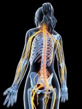 Study suggests radiologically isolated disease is part of MS spectrum