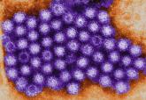 Norovirus sends 1.6 million to doctors every year