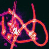 Postexposure prophylaxis may prevent Ebola disease development