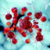 Noncanonical Wnt signaling implicated in antiandrogen-resistant prostate cancer