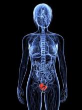 ASCO endorses EAU guidelines on advanced bladder cancer