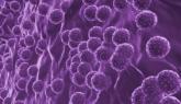 Unrecognized Hepatitis C Linked With Advanced Hepatic Fibrosis