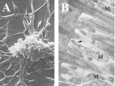 Stevens-Johnson syndrome cases differ based on cause