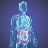 Outcomes of Stage III Colon Cancer Appear Better for Aspirin, COX-2 Inhibitor Users