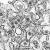 Zika virus: What clinicians must know