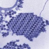 Consider Chikungunya virus in new-onset polyarthritis