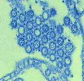 Study: Exposure History Critical to Design of Universal Flu Vaccine