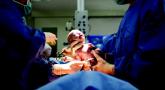 Cesarean rate is not doubled in nulliparous inductions