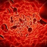 No VTE prophylaxis needed after joint surgery in patients with hemophilia