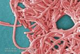 Legionellosis cases continue to increase nationwide