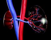 IMWG issues renal impairment recommendations for myeloma patients