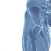 Osteoarthritis hip pain follows four distinct paths