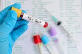 Testing, early antiretroviral treatment could slash HIV infection rate in men