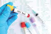 Screening for acute HIV infection raises diagnostic yield