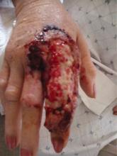 It Starts With a Dog Scratch