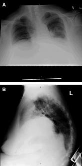 Short of breath, not short of diagnoses