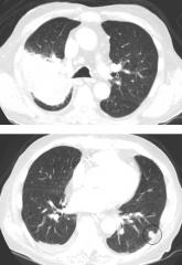 Overcome by Weakness