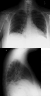 Making a List, Check It Twice