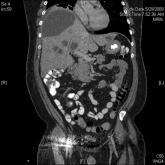 A Multiple Choice Answer?