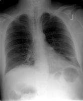 Clinical Conundrum