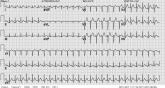 Clinical Conundrum