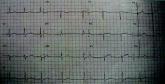 Clinical Conundrum