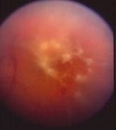 “String‐of‐Pearls”