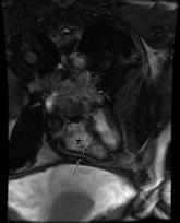 Thinking Inside the Box