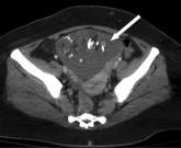 Chance Favors the Prepared Mind