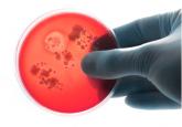 Follow-up blood cultures are often needed after bacteremia