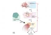 A paraneoplastic potassium and acid-base disturbance