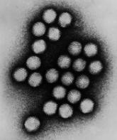 AdV viral burden linked to mortality in kids