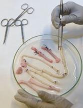 Team creates functional vascular grafts in a week