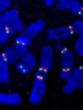 Gene plays crucial role in cancer development, team says